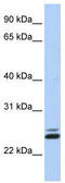 JAZF Zinc Finger 1 antibody, TA341526, Origene, Western Blot image 