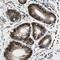 Inositol Hexakisphosphate Kinase 2 antibody, NBP1-89635, Novus Biologicals, Immunohistochemistry frozen image 