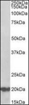 DnaJ Heat Shock Protein Family (Hsp40) Member C5 antibody, orb178869, Biorbyt, Western Blot image 