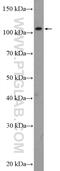 SET Domain Bifurcated Histone Lysine Methyltransferase 2 antibody, 14428-1-AP, Proteintech Group, Western Blot image 