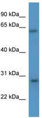 Cytokine Inducible SH2 Containing Protein antibody, TA340387, Origene, Western Blot image 