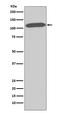 Dipeptidyl Peptidase 4 antibody, M00597, Boster Biological Technology, Western Blot image 