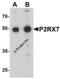 Purinergic Receptor P2X 7 antibody, 8015, ProSci, Western Blot image 