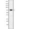 Chorionic Gonadotropin Subunit Beta 2 antibody, abx149258, Abbexa, Western Blot image 