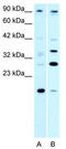 Poly(ADP-Ribose) Polymerase Family Member 11 antibody, TA334267, Origene, Western Blot image 