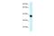 Homeobox A11 antibody, PA5-70380, Invitrogen Antibodies, Western Blot image 