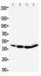 CCAAT Enhancer Binding Protein Alpha antibody, PA5-79029, Invitrogen Antibodies, Western Blot image 