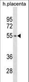 TARBP2 Subunit Of RISC Loading Complex antibody, LS-C161703, Lifespan Biosciences, Western Blot image 