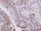 Uridine Monophosphate Synthetase antibody, GTX114872, GeneTex, Immunohistochemistry paraffin image 