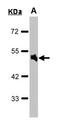 Adrenoceptor Alpha 1A antibody, LS-B4077, Lifespan Biosciences, Western Blot image 
