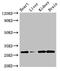 Guanylyl Cyclase Domain Containing 1 antibody, LS-C678156, Lifespan Biosciences, Western Blot image 