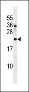 DnaJ Heat Shock Protein Family (Hsp40) Member C24 antibody, LS-C167476, Lifespan Biosciences, Western Blot image 