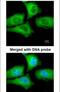 Chaperonin Containing TCP1 Subunit 5 antibody, PA5-22093, Invitrogen Antibodies, Immunofluorescence image 