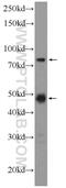 SET Domain And Mariner Transposase Fusion Gene antibody, 25814-1-AP, Proteintech Group, Western Blot image 