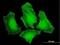 Fermitin Family Member 2 antibody, H00010979-M09, Novus Biologicals, Immunofluorescence image 