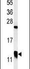 Cysteine-rich protein 1 antibody, PA5-24643, Invitrogen Antibodies, Western Blot image 