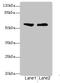 Ectonucleoside triphosphate diphosphohydrolase 2 antibody, LS-C675714, Lifespan Biosciences, Western Blot image 