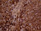 Methyltransferase Like 7A antibody, M14279, Boster Biological Technology, Immunohistochemistry paraffin image 