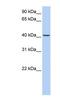 Transmembrane Protein 144 antibody, NBP1-91310, Novus Biologicals, Western Blot image 