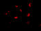 Metastasis Associated 1 Family Member 2 antibody, 2443, ProSci, Immunofluorescence image 