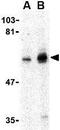 Protein Tyrosine Phosphatase Non-Receptor Type 11 antibody, GTX31745, GeneTex, Western Blot image 