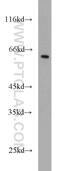 Meis Homeobox 2 antibody, 11550-1-AP, Proteintech Group, Western Blot image 
