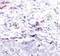 Cathepsin D antibody, PA5-17353, Invitrogen Antibodies, Immunohistochemistry paraffin image 