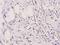BCL2 Associated Agonist Of Cell Death antibody, A03520S155, Boster Biological Technology, Immunohistochemistry frozen image 