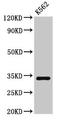 SET Nuclear Proto-Oncogene antibody, LS-C671129, Lifespan Biosciences, Western Blot image 