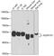 Aldehyde Dehydrogenase 1 Family Member A1 antibody, 18-207, ProSci, Western Blot image 