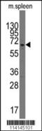 Poly(ADP-Ribose) Polymerase Family Member 3 antibody, 62-233, ProSci, Western Blot image 