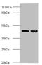 Rho GDP Dissociation Inhibitor Alpha antibody, A52636-100, Epigentek, Western Blot image 
