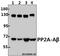 Protein Phosphatase 2 Scaffold Subunit Abeta antibody, A05756-2, Boster Biological Technology, Western Blot image 