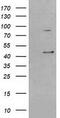 Serpin Family B Member 3 antibody, M04067, Boster Biological Technology, Western Blot image 