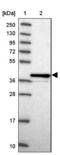 DNA Polymerase Beta antibody, NBP2-38600, Novus Biologicals, Western Blot image 