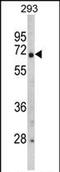 Glyceronephosphate O-Acyltransferase antibody, PA5-72492, Invitrogen Antibodies, Western Blot image 