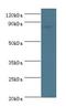 ATR Interacting Protein antibody, LS-C378840, Lifespan Biosciences, Western Blot image 