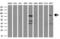 Neurotrophic Receptor Tyrosine Kinase 3 antibody, GTX83977, GeneTex, Western Blot image 