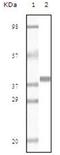 Myoglobin antibody, AM06141PU-N, Origene, Western Blot image 