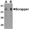 F-Box And Leucine Rich Repeat Protein 20 antibody, orb74931, Biorbyt, Western Blot image 