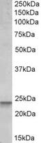 BCL2 Binding Component 3 antibody, NBP1-52093, Novus Biologicals, Western Blot image 