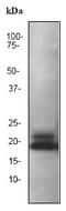 Synuclein Beta antibody, ab76111, Abcam, Western Blot image 