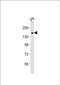 Tet Methylcytosine Dioxygenase 1 antibody, PA5-49432, Invitrogen Antibodies, Western Blot image 