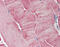 Aurora Kinase A antibody, 51-331, ProSci, Immunohistochemistry paraffin image 