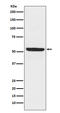 Sphingosine Kinase 1 antibody, M01390, Boster Biological Technology, Western Blot image 