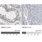 RNA Binding Motif Protein 28 antibody, NBP1-84632, Novus Biologicals, Immunohistochemistry paraffin image 