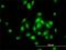 TBC1 Domain Containing Kinase antibody, H00093627-M01, Novus Biologicals, Immunofluorescence image 