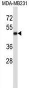 CD1a Molecule antibody, abx027451, Abbexa, Immunohistochemistry frozen image 