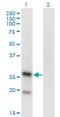 T-cell surface glycoprotein YE1/48 antibody, H00010748-M01, Novus Biologicals, Western Blot image 