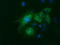 Fumarylacetoacetate Hydrolase Domain Containing 2A antibody, TA500975, Origene, Immunofluorescence image 